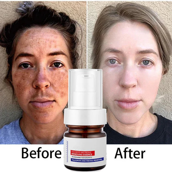 Sérum de visage anti-tâches à la vitamine C