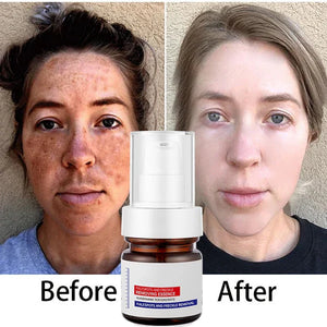 Sérum de visage anti-tâches à la vitamine C
