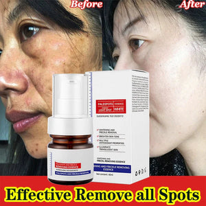 Sérum de visage anti-tâches à la vitamine C
