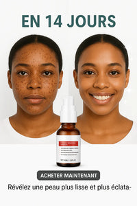 Sérum de visage anti-tâches à la vitamine C
