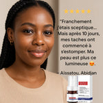 Charger l&#39;image dans la galerie, Sérum de visage anti-tâches à la vitamine C
