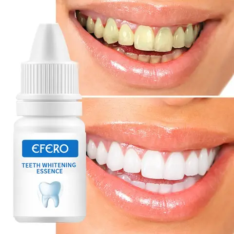 Efero blanchiment dentaire
